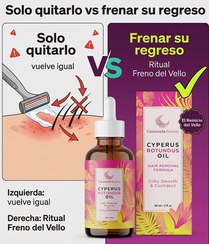 Menos vello. Sin dolor. Sin láser.