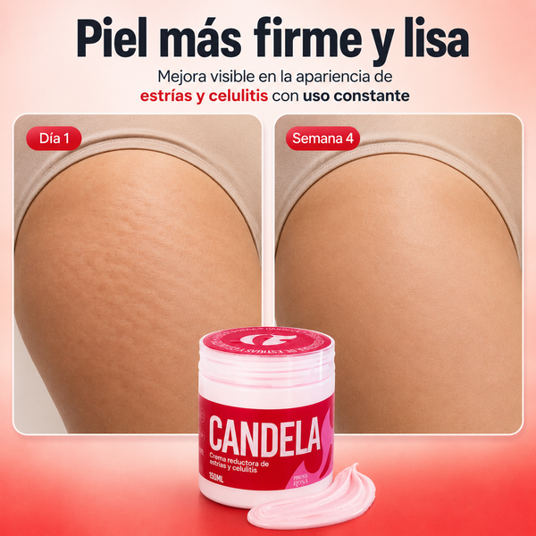 Candela 150 g | Crema Termoactiva para Estrías y Celulitis 3